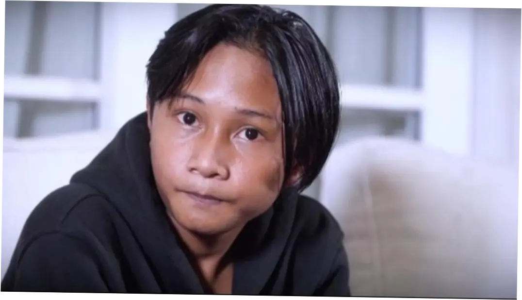 Fajar Sadboy Alami Kecelakaan Motor, Apa yang Terjadi?